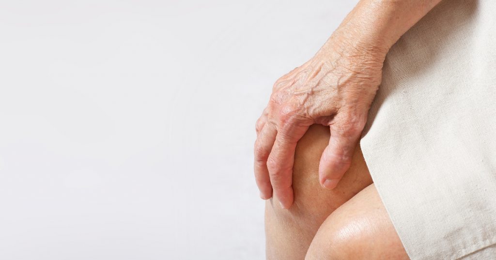 Bone Loss         Alzheimer’s