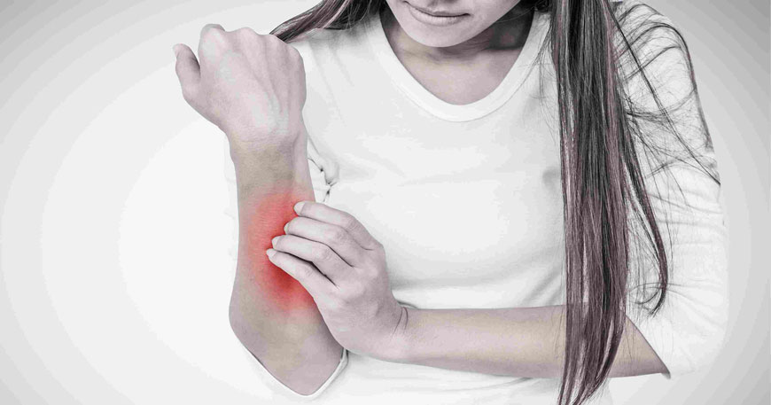 Eczema, Depression & Anxiety Links