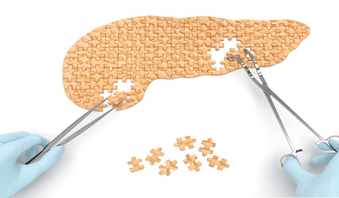 Pancreatic Cancer     A New Approach