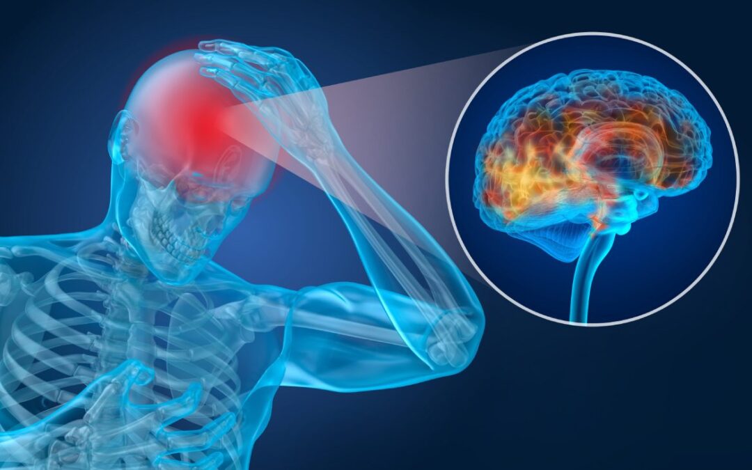 Traumatic Brain Injuries or TBIs